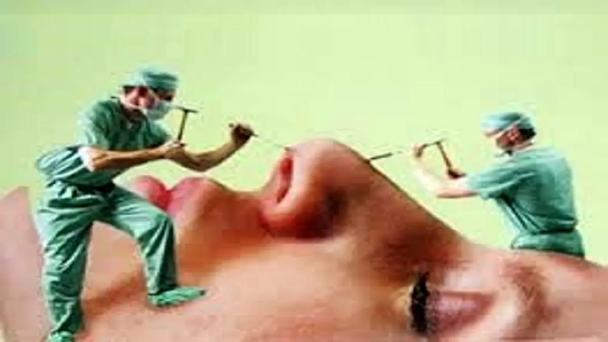 افزایش مردان متقاضی عمل زیبایی