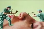 افزایش مردان متقاضی عمل زیبایی