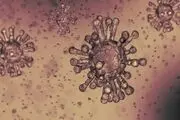 ۶ نکته مهم برای کنترل آلرژی فصلی در پاییز 