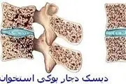 این داروها را کمتر مصرف کنید تا استخوان هایتان نشکند!