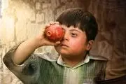 خدمتی که رهایم کن به کودکان سندرم داون کرد