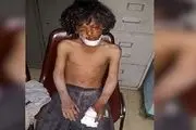 تبعات دردناک انفجار بمب خوشه ای بر کودکان یمن