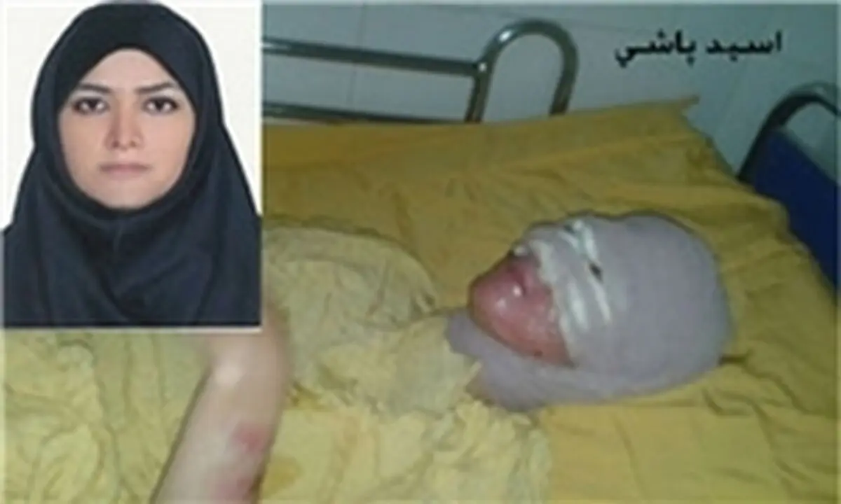 دومین جلسه دادگاه رسیدگی به پرونده اسیدپاشی