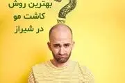 کاشت مو در در شیراز

