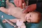 افشاگری پزشکان سوئدی از حادثه شیمیایی خان شیخون 