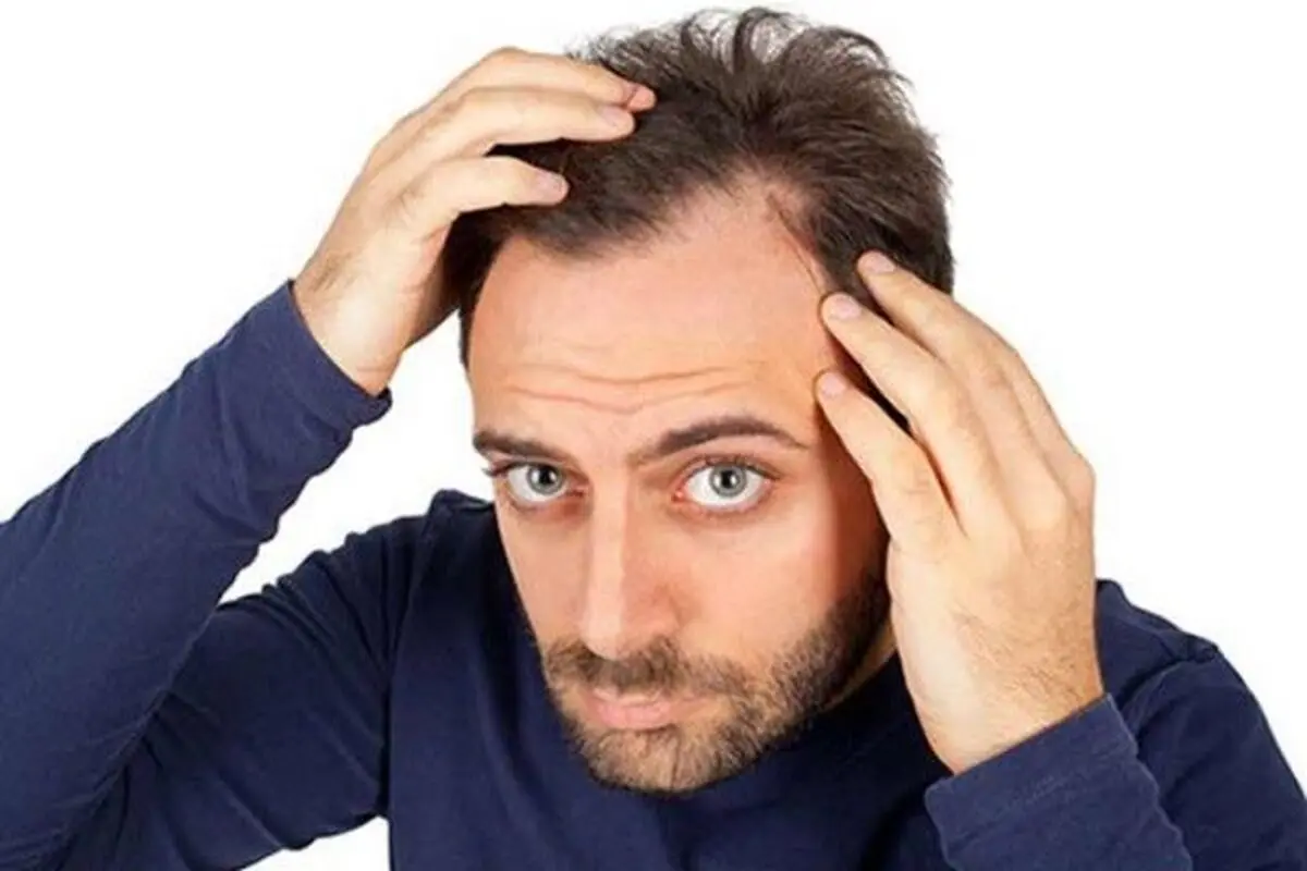  راه حل طلایی درمان ریزش مو