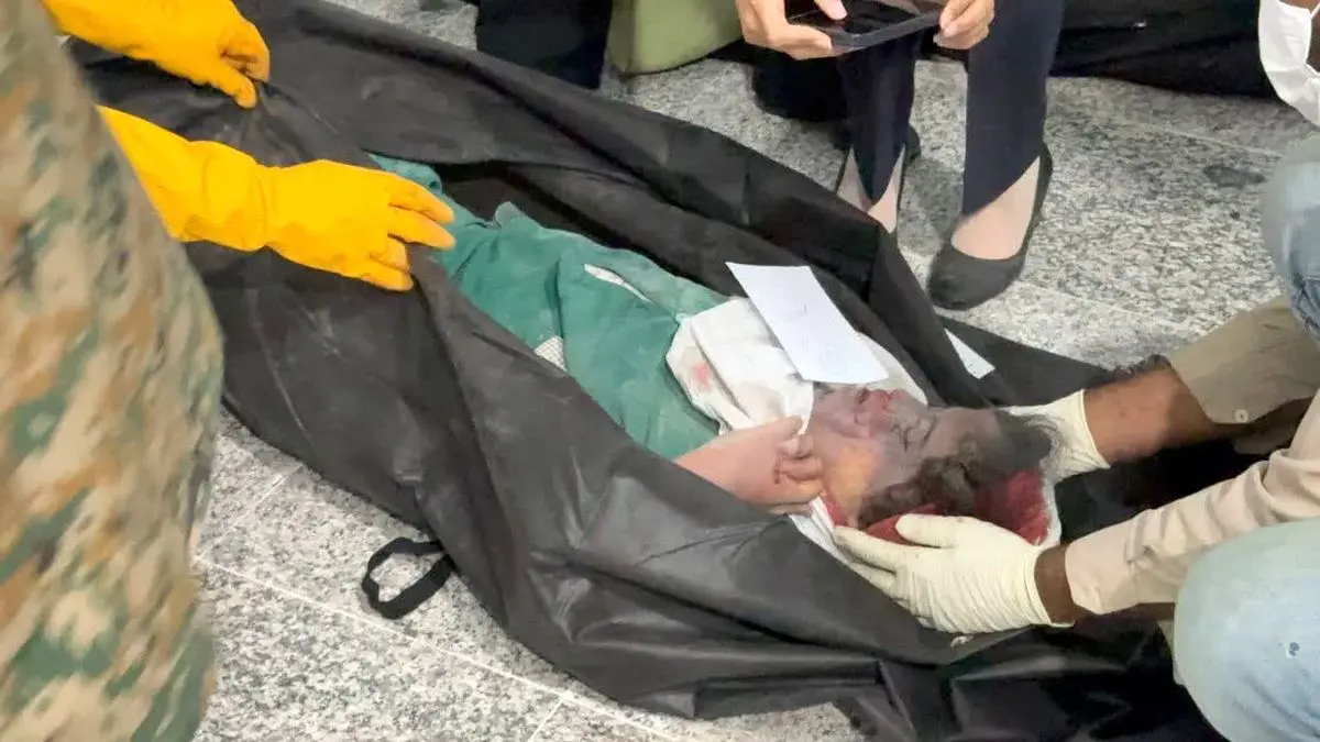 تصاویر دردناک از پیکر شهدای جنایت جنگیِ ترامپ در میناب