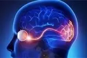علل افزایش تعداد بیماران مصروع
