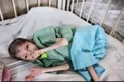 طرح جلوگیری از اختلال ژنتیکی در کشور اجرا می شود