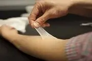 تولید جایگزینی مناسب برای ترمیم پوست دردانشگاه امیرکبیر 