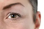 این میوه شما را جوان نگه می دارید