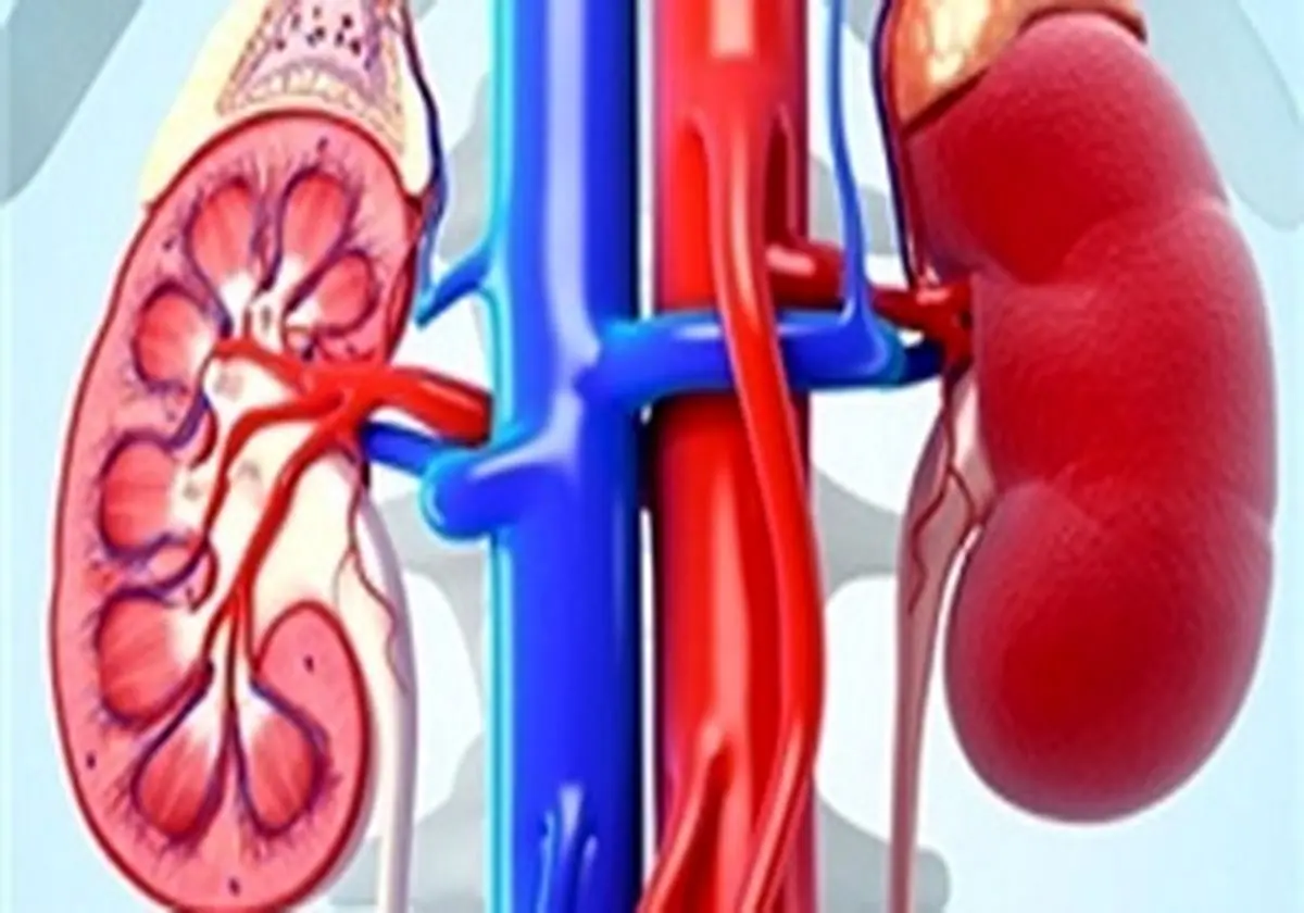 چگونه درد کلیه را تشخیص دهیم؟