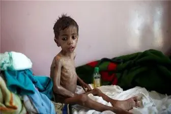 دیفتری جان 141 تن در یمن را گرفت
