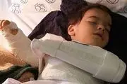 جراحی اشتباهی دست پسر بچه در بیمارستان اصفهان+عکس 