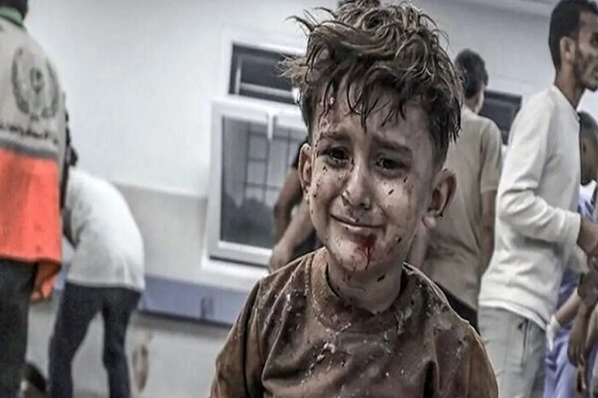 «حکم مرگ تدریجی» ۲۰۰ هزار مجروح غزه امضا می‌شود