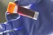 اگر این گروه خونی را دارید، خطر سکته زودرس در کمین شماست
