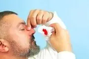چرا خون‌دماغ می‌شویم؟