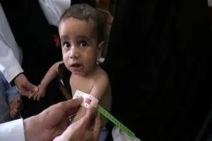 
خشم مردم یمن از اهداف سیاسی برنامه جهانی غذا
