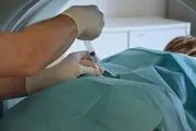 نحوه ی تزریق اوزون تراپی چگونه است؟ آیا تزریق اوزون تراپی دردناک است ؟
