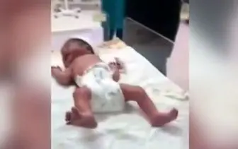 پیگیری‌ها از قطع انگشت نوزاد در بیمارستان شهریار به کجا رسید؟