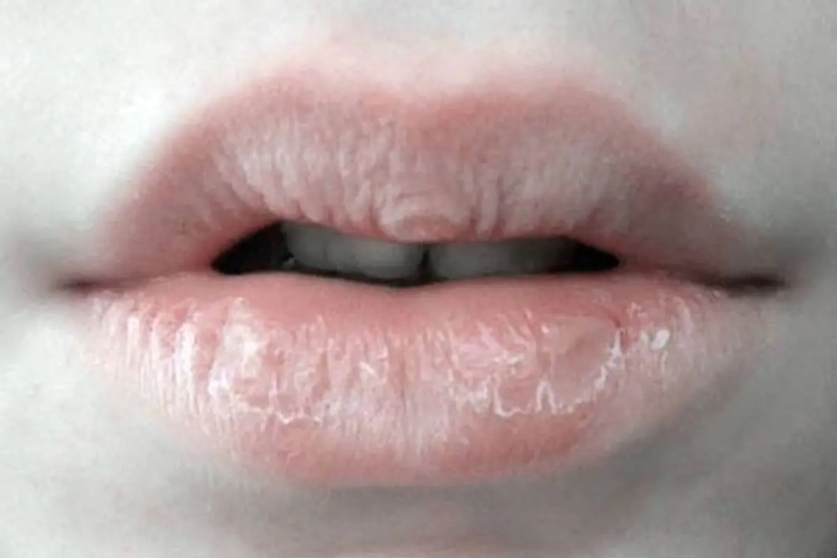 کندن و جویدن پوست لب و جاهاى دیگر بدن، چه حکمى دارد؟
