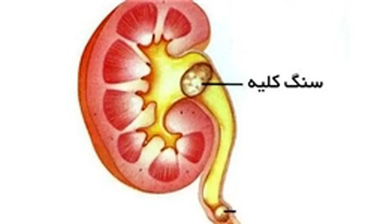کلیه سالم در رژیم غذایی صحیح