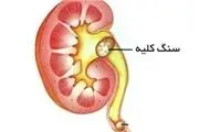 کلیه سالم در رژیم غذایی صحیح
