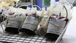 جمع‌آوری کیسه‌های فیلتردار غیراستاندارد خون