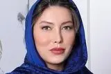 
تفاوت چهره فریبا نادری قبل و بعد از جراحی زیبایی
