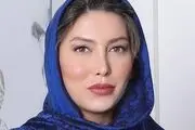 
تفاوت چهره فریبا نادری قبل و بعد از جراحی زیبایی
