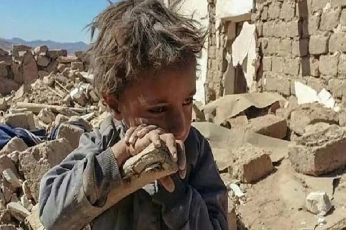 جان میلیونها یمنی به دلیل گرسنگی و بیماری در خطر است
