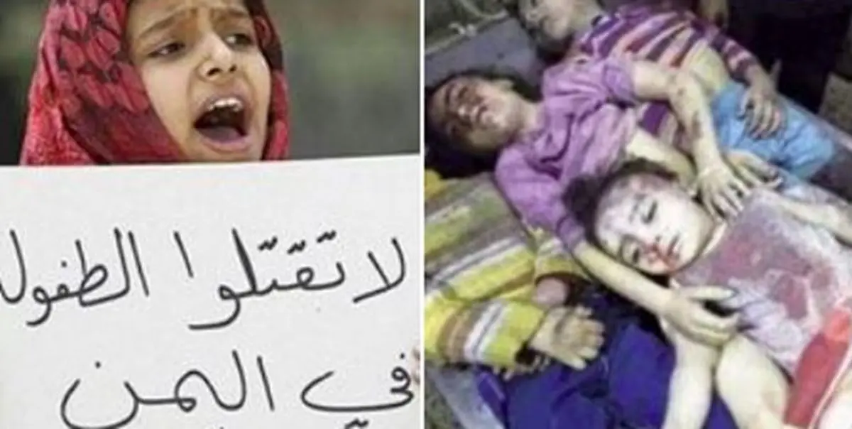 کشته و زخمی شدن 7000 کودک یمنی توسط عربستان