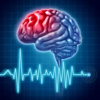 درمان سکته مغزی چگونه امکان پذیر است؟