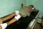 قطع شدن اعضای بدن کودکان یمنی توسط عرب ها