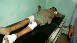قطع شدن اعضای بدن کودکان یمنی توسط عرب ها