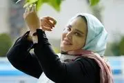 جراحی زیبایی که بین بازیگران ایرانی خیلی مٌد شده