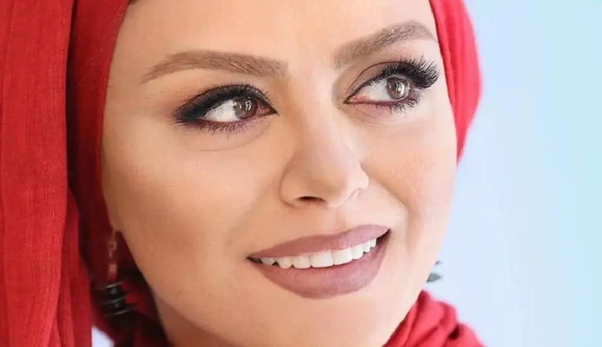 تغییر چهره ناگهانی شبنم فرشادجو /عکس