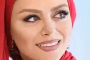 تغییر چهره ناگهانی شبنم فرشادجو /عکس