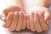تغذیه صحیح برای سلامت ناخن ها