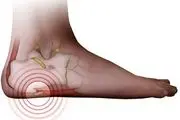 رایج‌ترین علل درد پاشنه پا