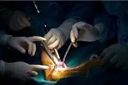 دلالیل افتادگی مچ پا چیست؟