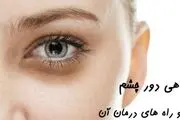 چگونه سیاهی و گودی زیر چشم را از بین ببریم؟