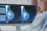 یافته جدید محققان در خصوص پیش بینی بازگشت دوباره سرطان سینه
