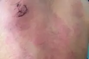 تنبیه با خط کش آهنی بخاطر بلد نبودن ریاضی!