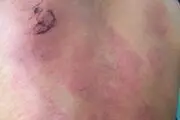 تنبیه با خط کش آهنی بخاطر بلد نبودن ریاضی!
