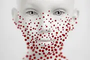 آیا ما هم زونا می گیریم؟