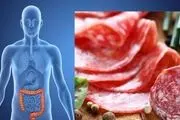 فست فود‌ها عامل ایجاد کننده سرطان روده بزرگ هستند
