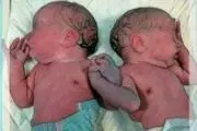 حمله مورچه ها به نوزادهای دو قلو رها شده +عکس