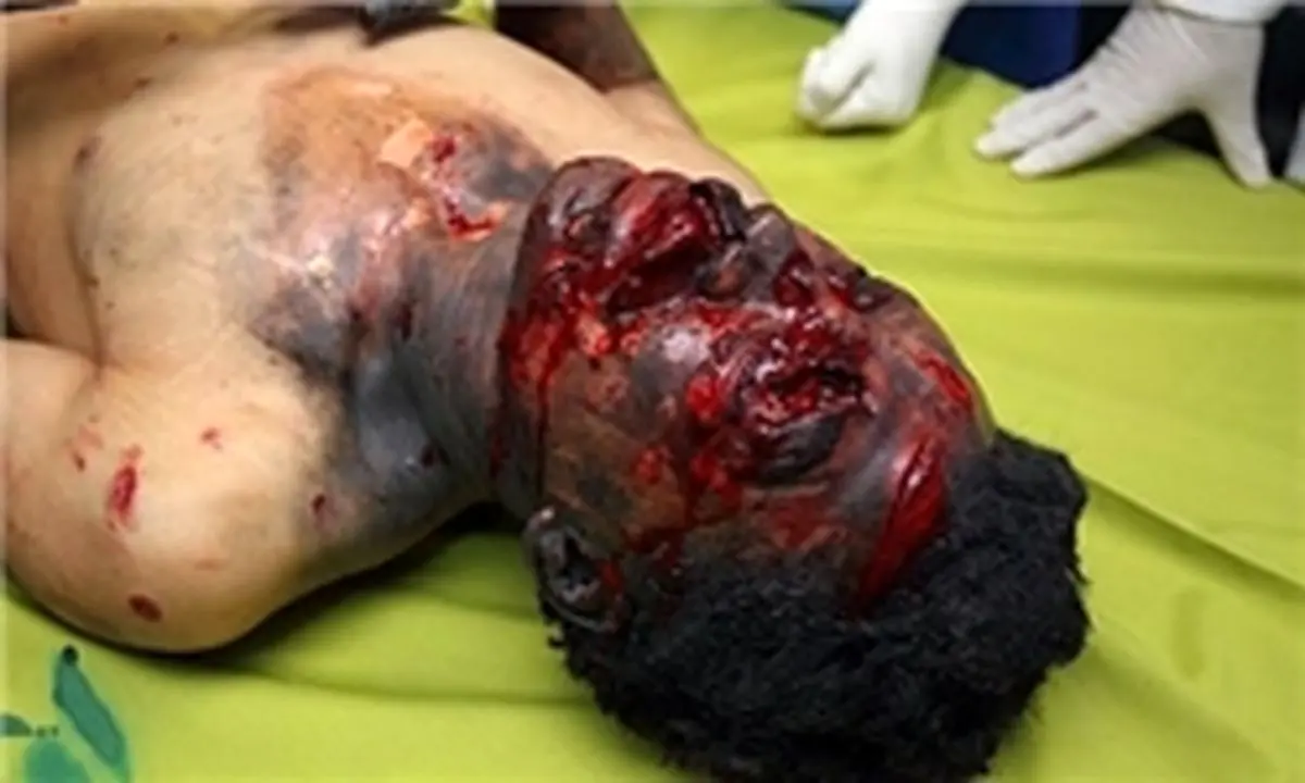 68 حادثه در شب چهارشنبه آخر سال