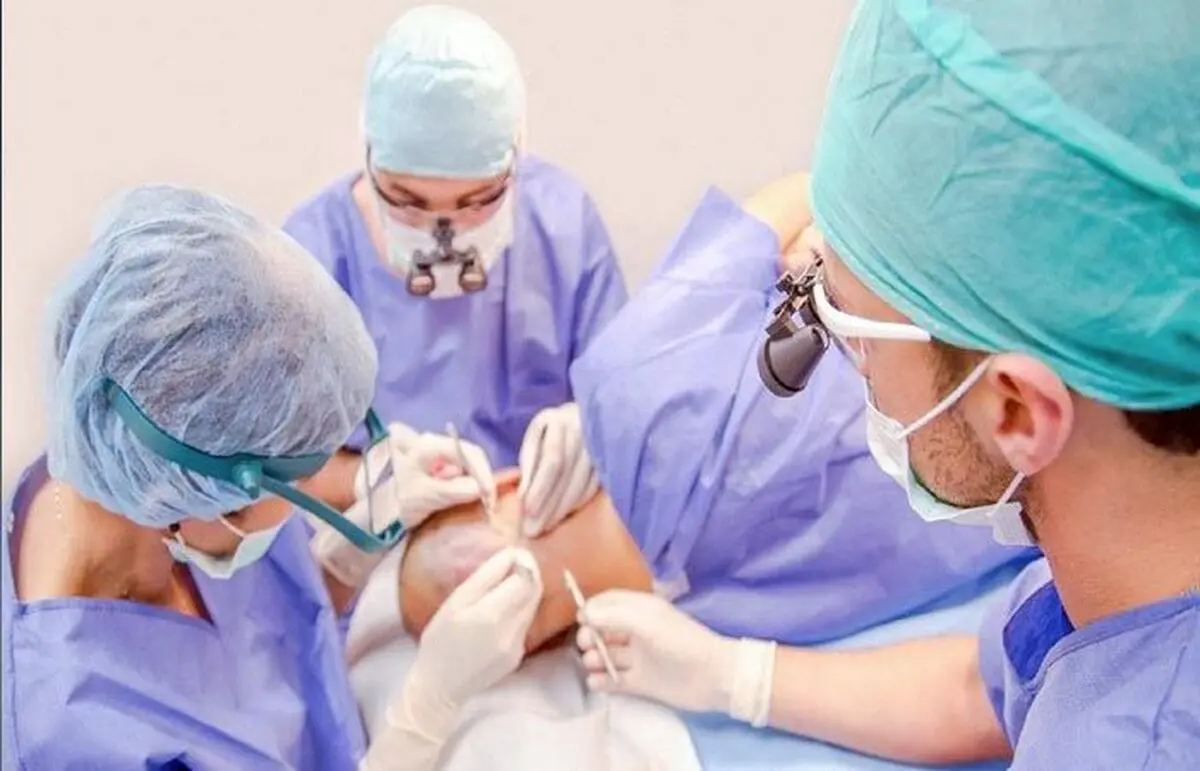 کاشت مو از بدن چگونه انجام می شود ؟
